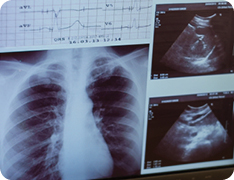 X-ray of human torso
